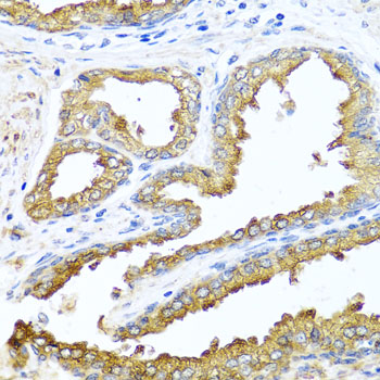 Immunohistochemistry - NCK2 Polyclonal Antibody 