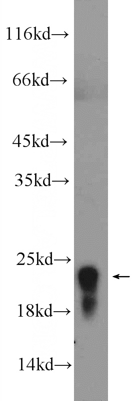 human blood tissue were subjected to SDS PAGE followed by western blot with Catalog No:111055(GP9 Antibody) at dilution of 1:1000