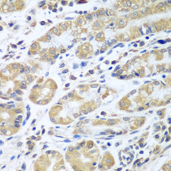 Immunohistochemistry - EIF1AX Polyclonal Antibody 