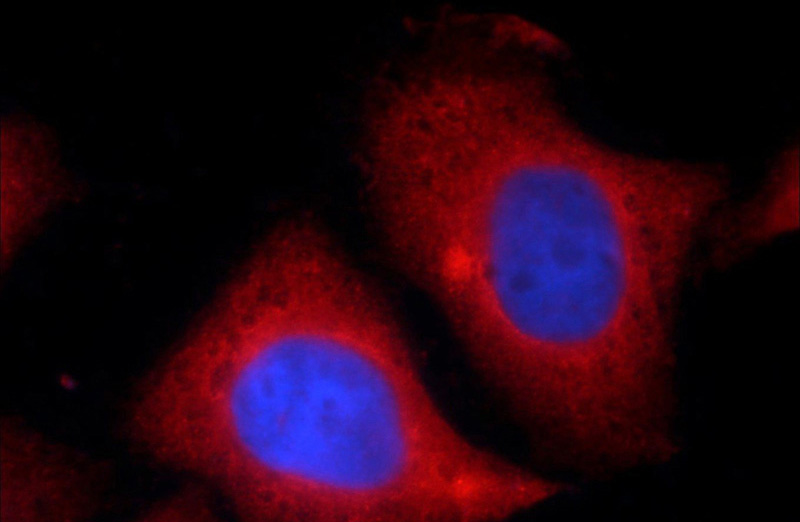 Immunofluorescent analysis of HepG2 cells using Catalog No:110362(ERK1/2 Antibody) at dilution of 1:25 and Rhodamine-Goat anti-Rabbit IgG
