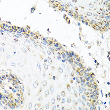 Immunohistochemistry - GNRH2 Polyclonal Antibody 