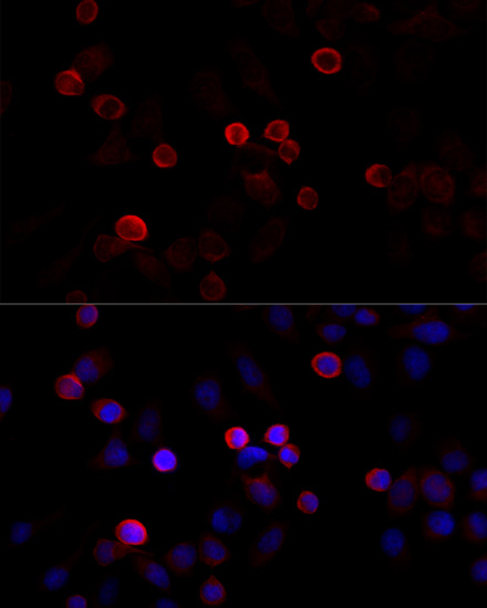 Immunofluorescence - FLNC Polyclonal Antibody 
