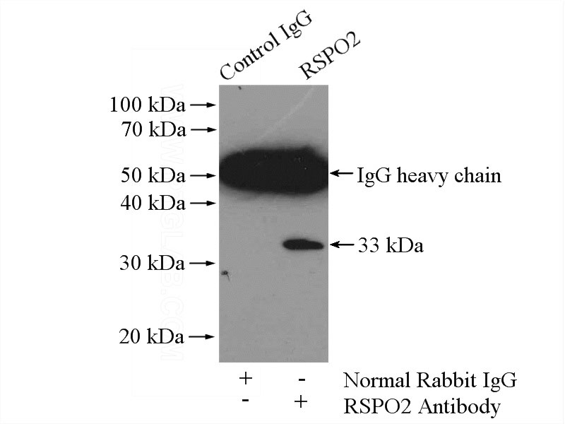 IP Result of anti-RSPO2 (IP:Catalog No:114851, 4ug; Detection:Catalog No:114851 1:500) with mouse brain tissue lysate 2640ug.