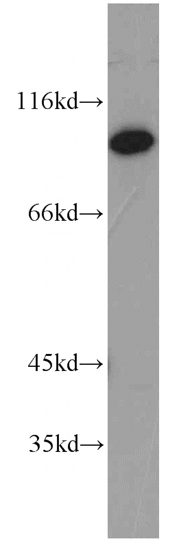 human brain tissue were subjected to SDS PAGE followed by western blot with Catalog No:111881(JAKMIP2 antibody) at dilution of 1:1500