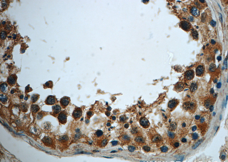 Immunohistochemistry of paraffin-embedded human testis slide using Catalog No:116103(TMEM168 Antibody) at dilution of 1:50