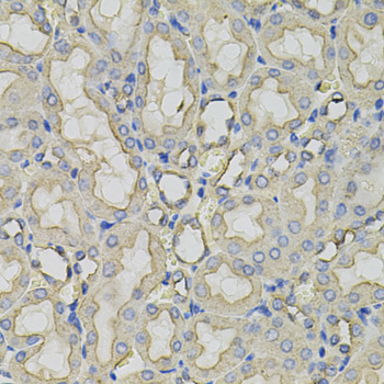 Immunohistochemistry - CLTC Polyclonal Antibody 