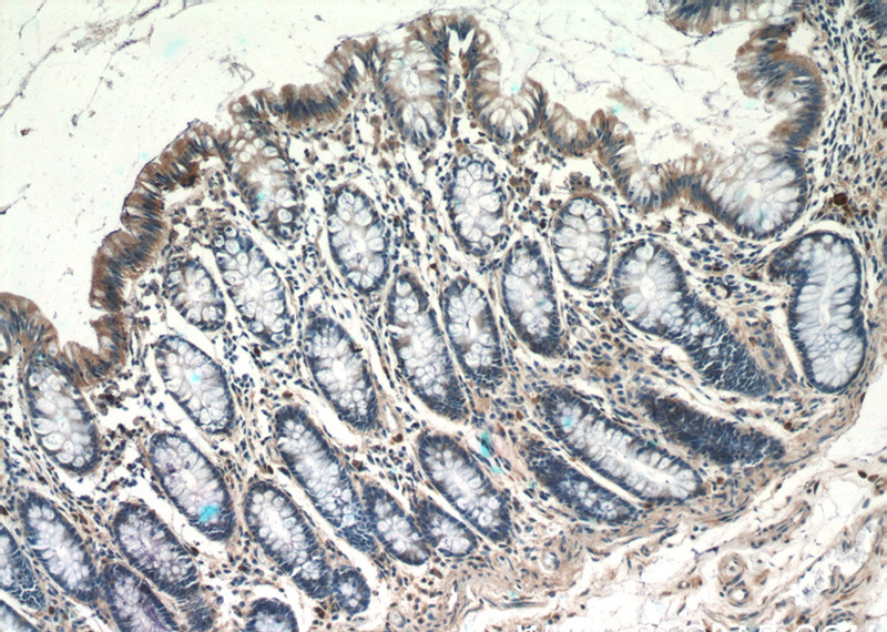 Immunohistochemistry of paraffin-embedded human colon tissue slide using Catalog No:116440(TSPAN1 Antibody) at dilution of 1:50 (under 10x lens)