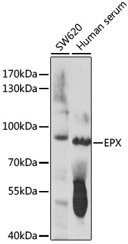 Western blot - EPX Polyclonal Antibody 