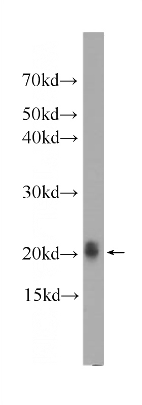 HeLa cells were subjected to SDS PAGE followed by western blot with Catalog No:107366(KRAS Antibody) at dilution of 1:1000