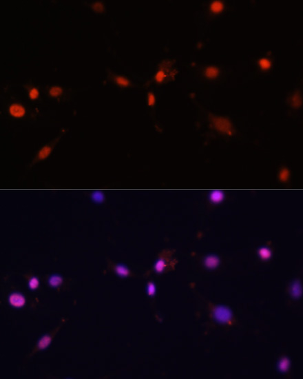 Immunofluorescence - MCM5 Polyclonal Antibody 