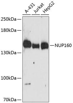 Western blot - NUP160 Polyclonal Antibody 