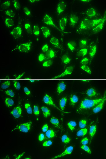 Immunofluorescence - SLC22A5 Polyclonal Antibody 