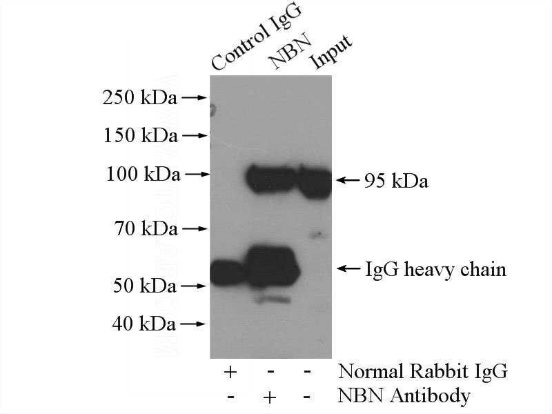 IP Result of anti-NBN (IP:Catalog No:112967, 4ug; Detection:Catalog No:112967 1:800) with HeLa cells lysate 880ug.