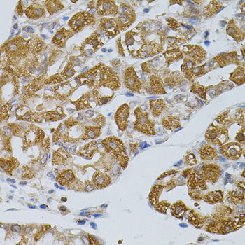 Immunohistochemistry - ASAH2 Polyclonal Antibody 