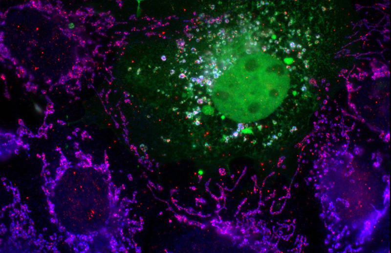 IF result of Catalog No:114725(anti-RNASET2) in COS7 cell by Dr. Nancy Kedersha. COS7 cells transiently transfected with FAST-KD4-YFP, counterstained with PTG RNASET2 antibody (red) and human anti-mitochondrial antigen in blue. Note that FAST-KD4-YFP overexpression alters mitchonrial morphology, and is also present at stress granules (green only).