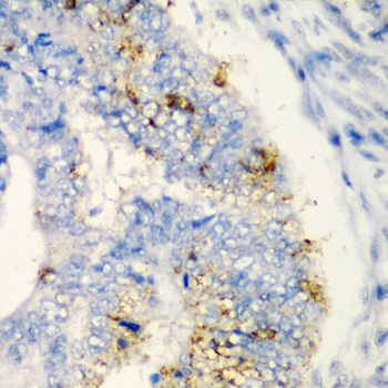 Immunohistochemistry - TIRAP Polyclonal Antibody 