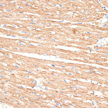Immunohistochemistry - KLHL9 Polyclonal Antibody 