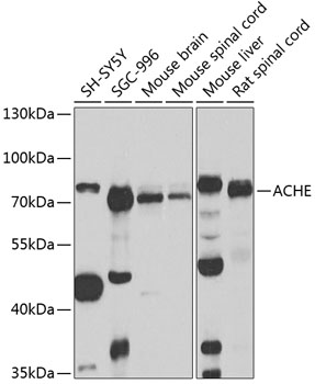 Western blot - ACHE Polyclonal Antibody 