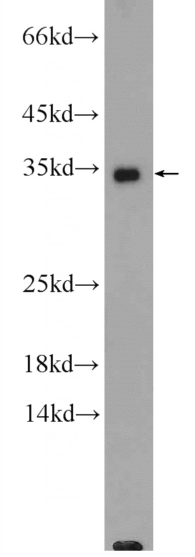 GADD45A Rabbit Polyclonal antibody