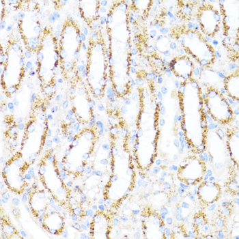 Immunohistochemistry - ALDH6A1 Polyclonal Antibody 