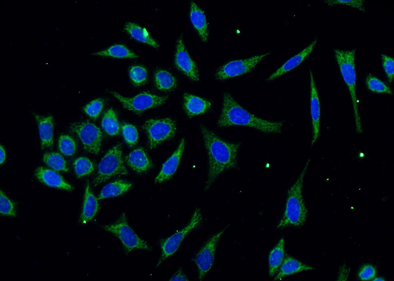 Immunofluorescent analysis of (-20oc Ethanol) fixed HeLa cells using Catalog No:108189(ARHGEF7 Antibody) at dilution of 1:25 and Alexa Fluor 488-congugated AffiniPure Goat Anti-Rabbit IgG(H+L)