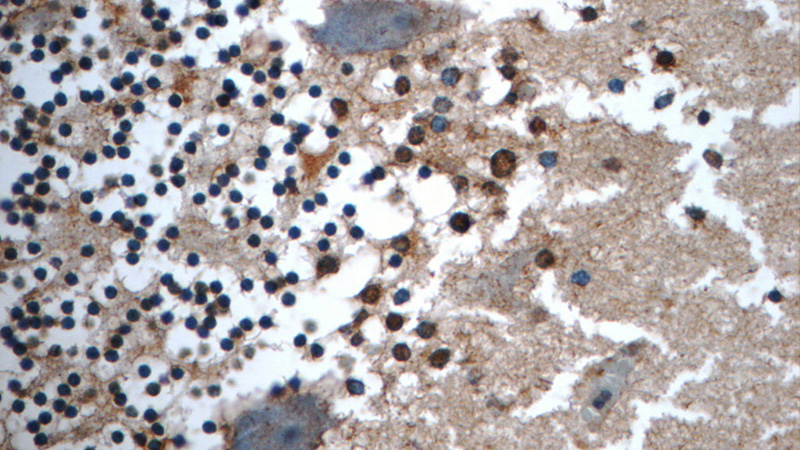 Immunohistochemistry of paraffin-embedded human cerebellum tissue slide using Catalog No:116817(WDR81 Antibody) at dilution of 1:50 (under 40x lens)