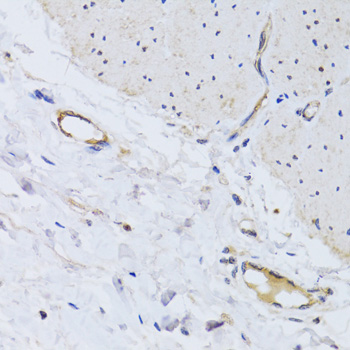 Immunohistochemistry - CD31 Polyclonal Antibody 