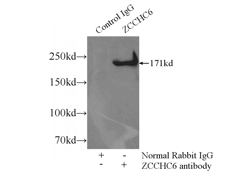 IP Result of anti-ZCCHC6 (IP:Catalog No:116934, 4ug; Detection:Catalog No:116934 1:1000) with HeLa cells lysate 1800ug.