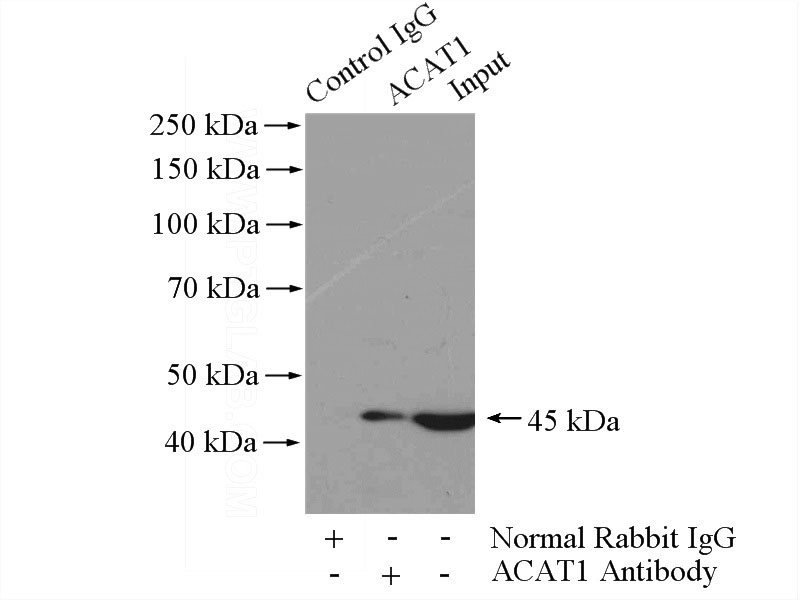 IP Result of anti-ACAT1 (IP:Catalog No:107727, 4ug; Detection:Catalog No:107727 1:500) with mouse heart tissue lysate 4400ug.