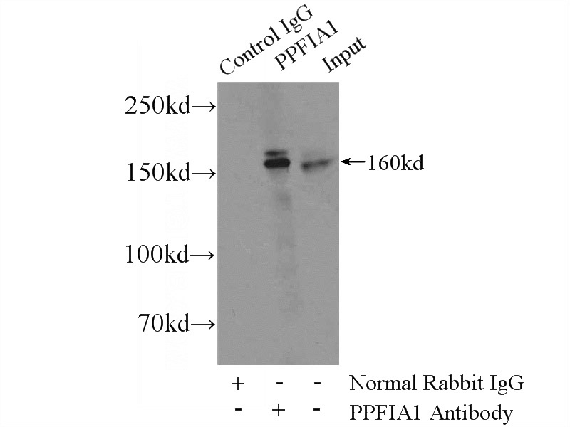 IP Result of anti-PPFIA1 (IP:Catalog No:112245, 4ug; Detection:Catalog No:112245 1:500) with MCF-7 cells lysate 3200ug.