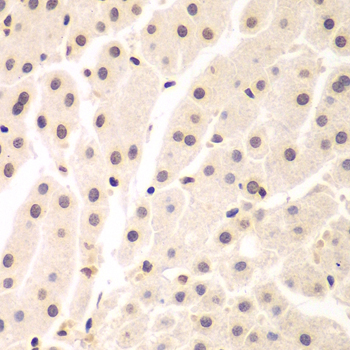 Immunohistochemistry - UHRF2 Polyclonal Antibody 