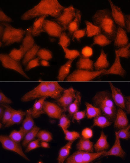 Immunofluorescence - PGC1 alpha Polyclonal Antibody 