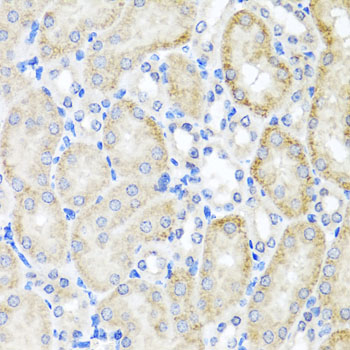 Immunohistochemistry - PSTPIP1 Polyclonal Antibody 