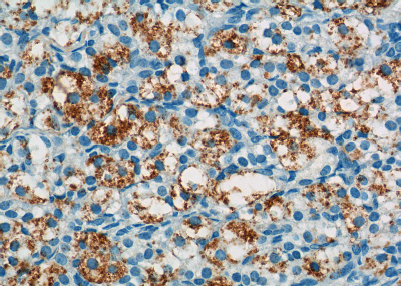 Immunohistochemistry of paraffin-embedded human ovary tissue slide using Catalog No:113704(PELI2 Antibody) at dilution of 1:50 (under 40x lens)