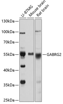 Western blot - GABRG2 Polyclonal Antibody 