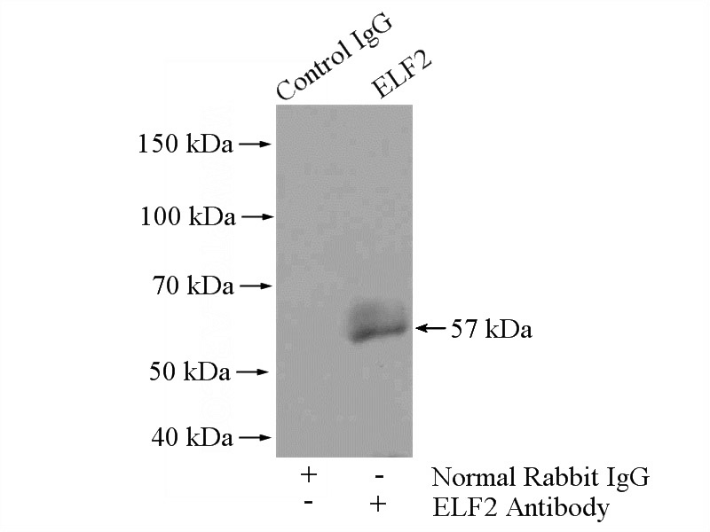 IP Result of anti-ELF2 (IP:Catalog No:110276, 4ug; Detection:Catalog No:110276 1:500) with A2780 cells lysate 960ug.