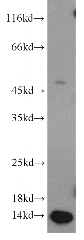 human skeletal muscle tissue were subjected to SDS PAGE followed by western blot with Catalog No:113684(PCBD2 antibody) at dilution of 1:500