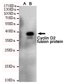 Western blot detection of Cyclin D2 in CHO-K1 cell lysateuff08Auff09and CHO-K1 transfected by Cyclin D2-fragment EGFP fusion proteinuff08Buff09cell lysate using Cyclin D2 mouse mAb (1:1000 diluted).Predicted band size:38KDa.Observed band size:38KDa.