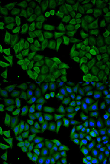 Immunofluorescence - CHRNA1 Polyclonal Antibody 