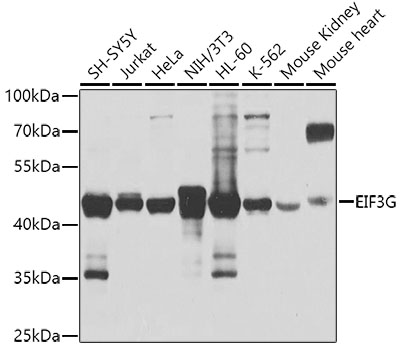 Western blot - EIF3G Polyclonal Antibody 
