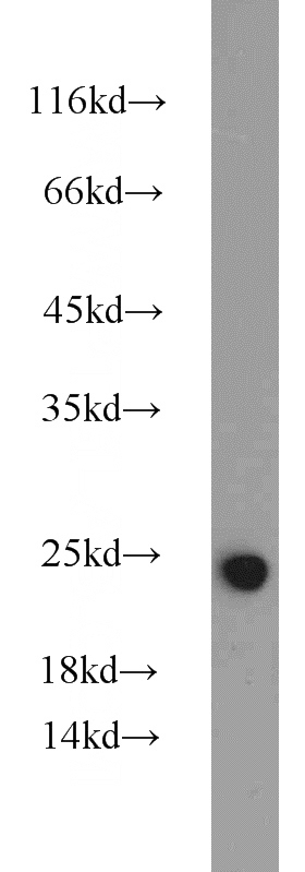 HeLa cells were subjected to SDS PAGE followed by western blot with Catalog No:114182(Pre-IL18 antibody) at dilution of 1:1000
