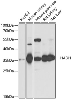 Western blot - HADH Polyclonal Antibody 