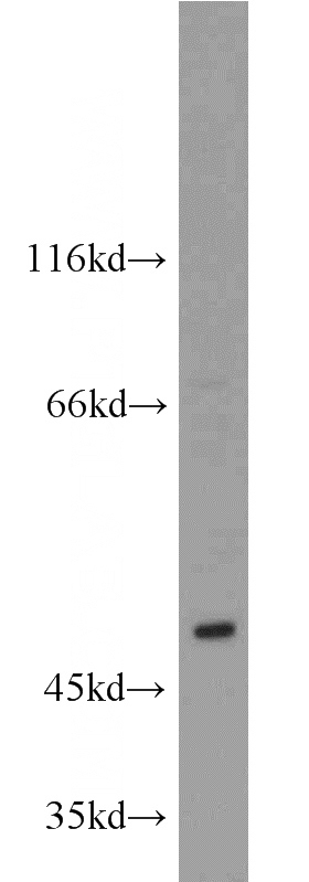 Jurkat cells were subjected to SDS PAGE followed by western blot with Catalog No:107849(AID antibody) at dilution of 1:800