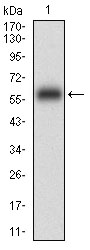 Western blot analysis using EPCAM mAb against human EPCAM (AA