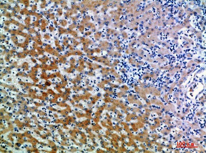 Fig1:; Immunohistochemical analysis of paraffin-embedded human-liver, antibody was diluted at 1:200