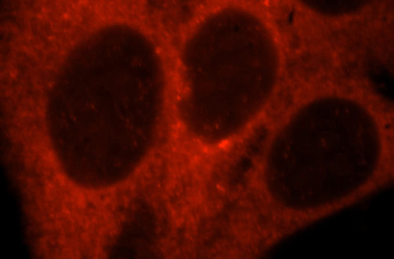 Immunofluorescent analysis of HepG2 cells, using GUF1 antibody Catalog No:111252 at 1:25 dilution and Rhodamine-labeled goat anti-rabbit IgG (red).
