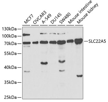 Western blot - SLC22A5 Polyclonal Antibody 