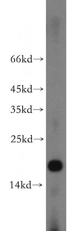 human brain tissue were subjected to SDS PAGE followed by western blot with Catalog No:113412(NUDCD2 antibody) at dilution of 1:500