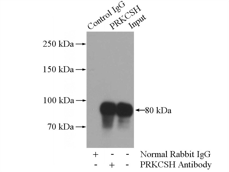 IP Result of anti-PRKCSH (IP:Catalog No:114200, 4ug; Detection:Catalog No:114200 1:1000) with HeLa cells lysate 2000ug.