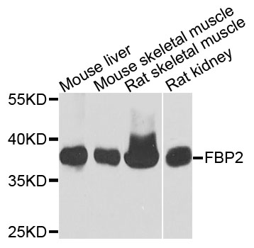 Western blot - FBP2 Polyclonal Antibody 